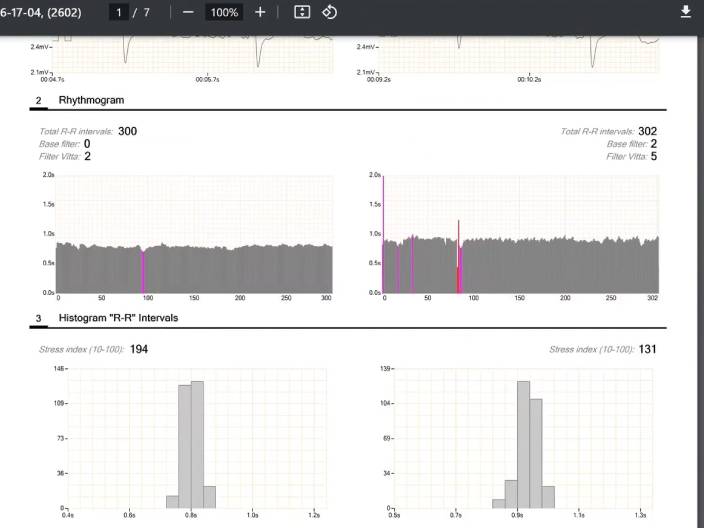 Before & After Thermography